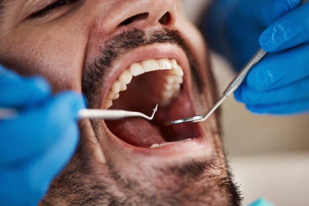 Best Dentist for Severe Toothache  in Lago Vista, TX